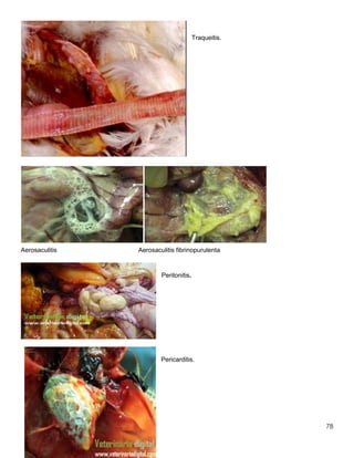 78
Traqueitis.
Aerosaculitis Aerosaculitis fibrinopurulenta
Peritonitis.
Pericarditis.
 