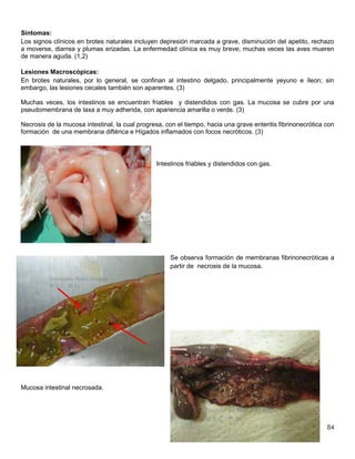 84
Síntomas:
Los signos clínicos en brotes naturales incluyen depresión marcada a grave, disminución del apetito, rechazo
a moverse, diarrea y plumas erizadas. La enfermedad clínica es muy breve; muchas veces las aves mueren
de manera aguda. (1,2)
Lesiones Macroscópicas:
En brotes naturales, por lo general, se confinan al intestino delgado, principalmente yeyuno e íleon; sin
embargo, las lesiones cecales también son aparentes. (3)
Muchas veces, los intestinos se encuentran friables y distendidos con gas. La mucosa se cubre por una
pseudomembrana de laxa a muy adherida, con apariencia amarilla o verde. (3)
Necrosis de la mucosa intestinal, la cual progresa, con el tiempo, hacia una grave enteritis fibrinonecrótica con
formación de una membrana diftérica e Hígados inflamados con focos necróticos. (3)
Intestinos friables y distendidos con gas.
Se observa formación de membranas fibrinonecróticas a
partir de necrosis de la mucosa.
Mucosa intestinal necrosada.
 