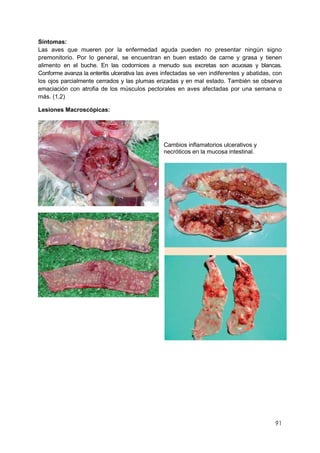 91
Síntomas:
Las aves que mueren por la enfermedad aguda pueden no presentar ningún signo
premonitorio. Por lo general, se encuentran en buen estado de carne y grasa y tienen
alimento en el buche. En las codornices a menudo sus excretas son acuosas y blancas.
Conforme avanza la enteritis ulcerativa las aves infectadas se ven indiferentes y abatidas, con
los ojos parcialmente cerrados y las plumas erizadas y en mal estado. También se observa
emaciación con atrofia de los músculos pectorales en aves afectadas por una semana o
más. (1,2)
Lesiones Macroscópicas:
Cambios inflamatorios ulcerativos y
necróticos en la mucosa intestinal.
 