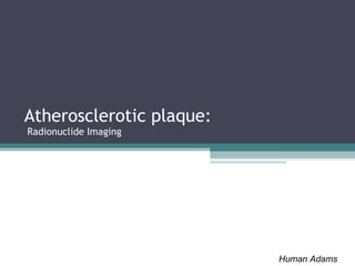 Atherosclerotic plaque:  Radionuclide Imaging Human Adams 