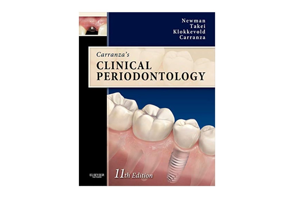 Read carranza s clinical periodontology expert consult text with