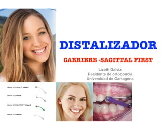 DISTALIZADOR
CARRIERE -SAGITTAL FIRST
Lizeth Galviz
Residente de ortodoncia
Universidad de Cartagena
 
