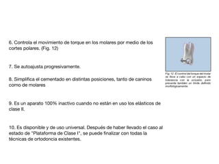 6. Controla el movimiento de torque en los molares por medio de los
cortes polares. (Fig. 12)

 
7. Se autoajusta progresivamente. 

8. Simpliﬁca el cementado en distintas posiciones, tanto de caninos
como de molares

 
9. Es un aparato 100% inactivo cuando no están en uso los elásticos de
clase II.

 
10. Es disponible y de uso universal. Después de haber llevado el caso al
estado de "Plataforma de Clase I", se puede ﬁnalizar con todas la
técnicas de ortodoncia existentes.
 