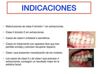 INDICACIONES
• Maloclusiones de clase II división 1 sin extracciones.

• Clase II división 2 sin extracciones. 

• Casos de clase II unilateral o asimétrica. 

• Casos en tratamiento con aparatos ﬁjos que han
perdido anclaje y precisan recuperar espacio.

• Clase I que presentan mesialización de los molares. 

• Los casos de clase II y de clase I que precisan 4
extracciones, conseguir un resultado mejor en la
estética facial. 
 