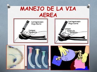 MANEJO DE LA VIA
AEREA
 