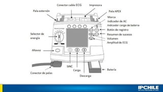 Carro de paro