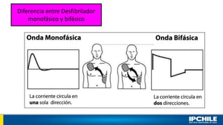 Diferencia entre Desfibrilador
monofásico y bifásico
 