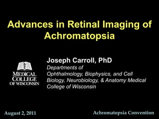 Advances in Retinal Imaging of Achromatopsia Joseph Carroll, PhD Departments of Ophthalmology, Biophysics, and Cell Biology, Neurobiology, & Anatomy Medical College of Wisconsin Achromatopsia Convention August 2, 2011 