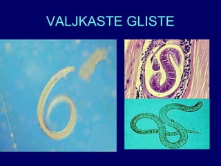 VALJKASTE GLISTE
 