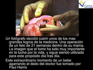 Un fotógrafo decidió cubrir unos de los mas grandes logros de la medicina. Una operación de un feto de 21 semanas dentro de su mama. La imagen que el tomo ha sido muy importante en la lucha por la vida, y sigue siendo utilizada para este propósito día tras día. Este extraordinario momento de un bebe agarrando el dedo del doctor fue tomado por Paul Harris 