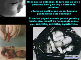 Diles que se detengan, te juro que ya voy a
    portarme bien y no voy a darte más
                 patadas.
   ¿Cómo es posible que un ser humano
       pueda hacer ésto conmigo?

 Él me las pagará cuando yo sea grande y
 fuerte, ¡Ay, mamá! Ya no aguanto más...
  ay... mamita, mamita, ayúdame...
 
