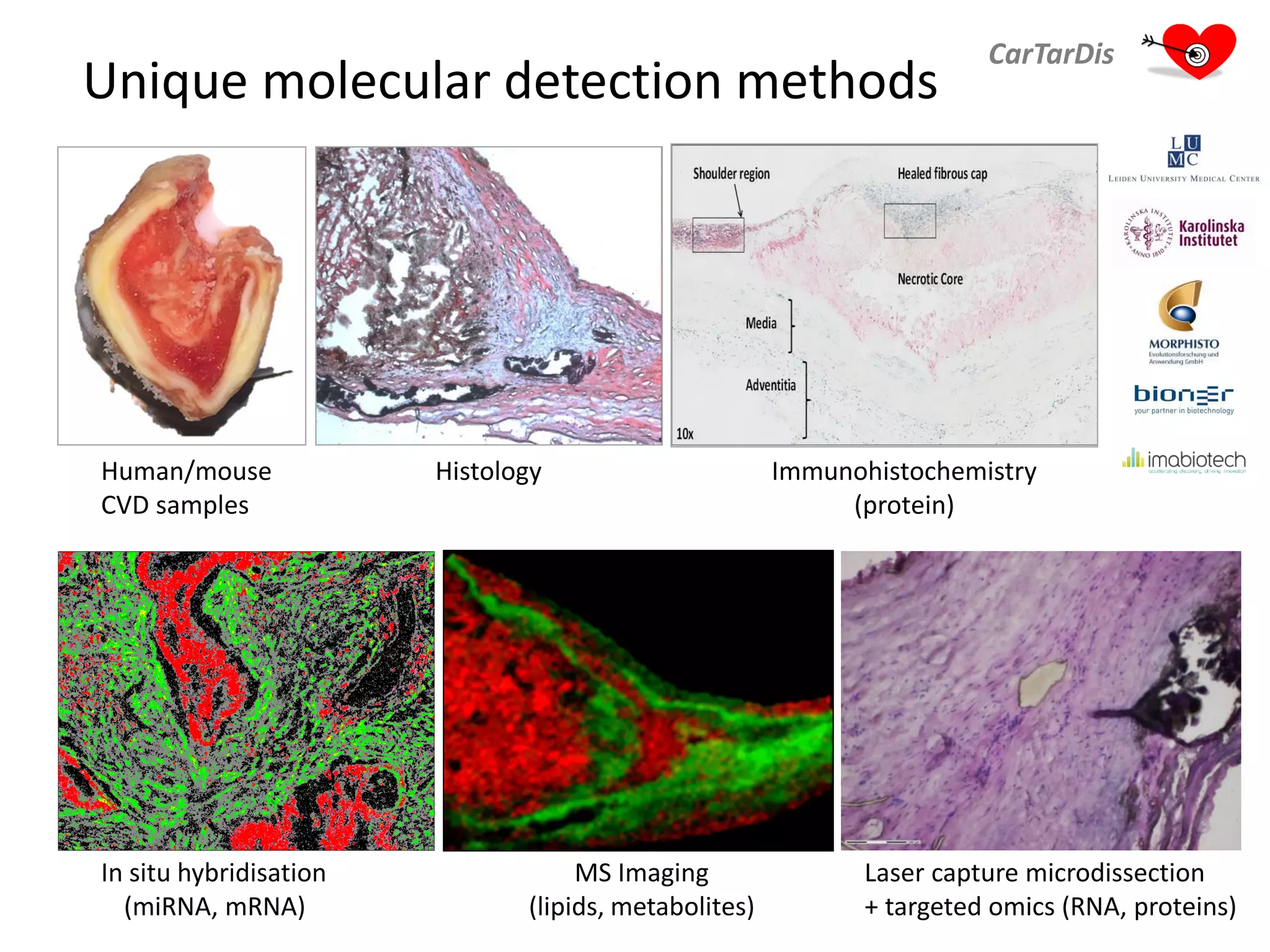 Unique molecular detection methods
CarTarDis
Immunohistochemistry
(protein)
In situ hybridisation
(miRNA, mRNA)
MS Imaging
(lipids, metabolites)
Human/mouse
CVD samples
Laser capture microdissection
+ targeted omics (RNA, proteins)
Histology
 