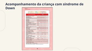 Acompanhamento da criança com síndrome de
Down
 