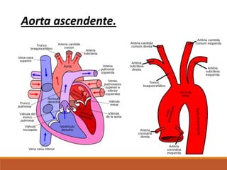 Aorta ascendente.
 