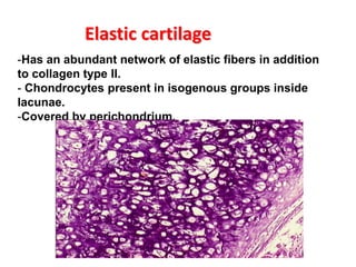 Elastic cartilage
-Has an abundant network of elastic fibers in addition
to collagen type II.
- Chondrocytes present in isogenous groups inside
lacunae.
-Covered by perichondrium.
 