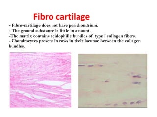 Fibro cartilage
- Fibro-cartilage does not have perichondrium.
- The ground substance is little in amount.
-The matrix contains acidophilic bundles of type I collagen fibers.
- Chondrocytes present in rows in their lacunae between the collagen
bundles.
 