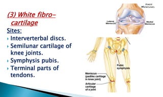 (3) White fibro-
cartilage
Sites:
 Interverterbal discs.
 Semilunar cartilage of
knee joints.
 Symphysis pubis.
 Terminal parts of
tendons.
 