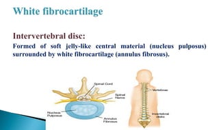 Intervertebral disc:
Formed of soft jelly-like central material (nucleus pulposus)
surrounded by white fibrocartilage (annulus fibrosus).
 