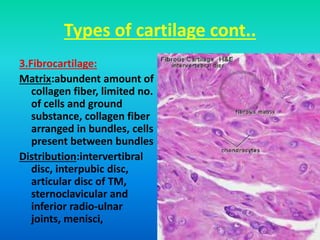 Types of cartilage cont..
3.Fibrocartilage:
Matrix:abundent amount of
collagen fiber, limited no.
of cells and ground
substance, collagen fiber
arranged in bundles, cells
present between bundles
Distribution:intervertibral
disc, interpubic disc,
articular disc of TM,
sternoclavicular and
inferior radio-ulnar
joints, menisci,
 