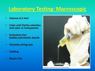 Laboratory Testing: Macroscopic
• Volume-0.2-4ml
• Color and Clarity-colorless
and clear or transparent.
• Inclusions-rice
bodies,ochronotic shards
• Viscosity-string test
• Clotting
• Mucin Clot
 