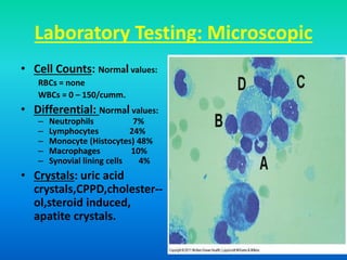 Laboratory Testing: Microscopic
• Cell Counts: Normal values:
RBCs = none
WBCs = 0 – 150/cumm.
• Differential: Normal values:
– Neutrophils 7%
– Lymphocytes 24%
– Monocyte (Histocytes) 48%
– Macrophages 10%
– Synovial lining cells 4%
• Crystals: uric acid
crystals,CPPD,cholester--
ol,steroid induced,
apatite crystals.
 