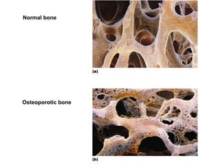 Cartilage & bones | PPT