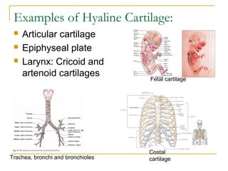 Examples of Hyaline Cartilage:
 Articular cartilage
 Epiphyseal plate
 Larynx: Cricoid and
artenoid cartilages
Costal
cartilageTrachea, bronchi and bronchioles
Fetal cartilage
 