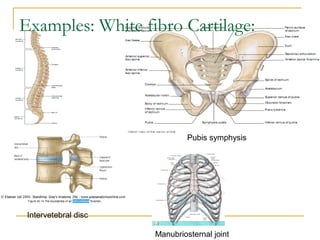 Pubis symphysisIntervertebral
disc
Manubriosternal joint
Intervetebral disc
Examples: White fibro Cartilage:
 