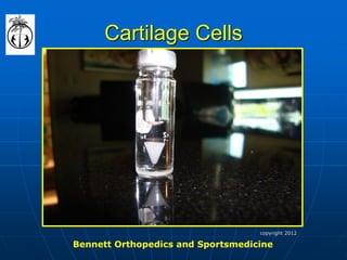 Cartilage Cells 
Bennett Orthopedics and Sportsmedicine 
copyright 2012  