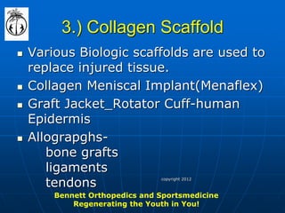 3.) Collagen Scaffold 
Various Biologic scaffolds are used to replace injured tissue. 
Collagen Meniscal Implant(Menaflex) 
Graft Jacket_Rotator Cuff-human Epidermis 
Allograpghs- bone grafts ligaments tendons 
Bennett Orthopedics and Sportsmedicine Regenerating the Youth in You! 
copyright 2012  