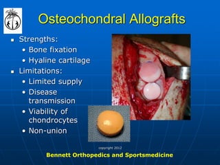 Osteochondral Allografts 
Strengths: 
•Bone fixation 
•Hyaline cartilage 
Limitations: 
•Limited supply 
•Disease transmission 
•Viability of chondrocytes 
•Non-union 
Bennett Orthopedics and Sportsmedicine 
copyright 2012  