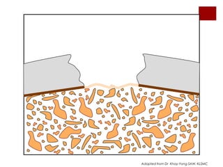 Adapted from Dr Khay-Yong SAW, KLSMC

 