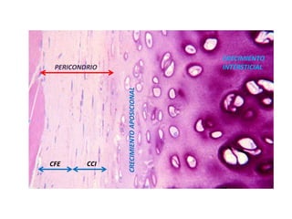 PERICONDRIO
CFE CCI
CRECIMIENTOAPOSICIONAL
CRECIMIENTO
INTERSTICIAL
 