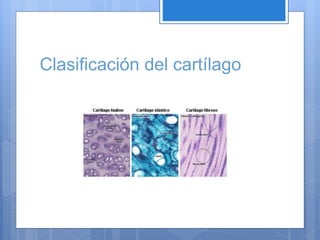 Clasificación del cartílago
 