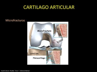 El Cartílago articular en la rodilla | PPT