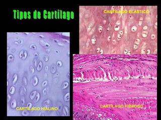 CARTÍLAGO ELÁSTICO




                    CARTÍLAGO FIBROSO
CARTÍLAGO HIALINO
 