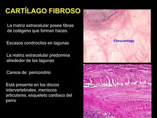 CARTÍLAGO FIBROSO
La matriz extracelular posee fibras
de colágeno que forman haces.

Escasos condrocitos en lagunas

La matriz extracelular predomina
alrededor de las lagunas

Carece de pericondrio

Está presente en los discos
intervertebrales, meniscos
articulares, esqueleto cardiaco del
perro
 