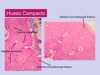 Hueso Compacto
                                                   Sistema Circunferencial Externo




            Sistema Intersticial




Sistema de Havers




                               Sistema Circunferencial Interno
 