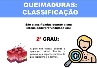 QUEIMADURAS:
CLASSIFICAÇÃO
São classificadas quanto a sua
intensidade/profundidade em:
2º GRAU:
A pele fica rosada, dolorida e
aparecem bolhas. Envolve a
primeira e a segunda camada da
pele (epiderme e a derme).
 