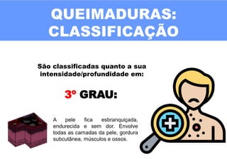 QUEIMADURAS:
CLASSIFICAÇÃO
São classificadas quanto a sua
intensidade/profundidade em:
3º GRAU:
A pele fica esbranquiçada,
endurecida e sem dor. Envolve
todas as camadas da pele, gordura
subcutânea, músculos e ossos.
 
