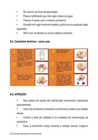 22 | Doenças sexualmente transmissíveis
• Só colocar na hora da ejaculação
• Passar lubrificante que não seja à base de água
• Transar 2 vezes com a mesma camisinha
• Guardar em lugar incorreto (carteira, porta-luva ou qualquer lugar
aquecido)
• Abrir com os dentes ou outros objetos cortantes.
8.5. Camisinha feminina - como usar
8.6. ATENÇÃO!
• Nos postos de saúde são distribuídas camisinhas masculinas
gratuitamente.
• Use uma camisinha (masculina ou feminina) a cada nova relação
sexual.
• Confira a data de validade e os cuidados de conservação da
camisinha.
• Caso a camisinha rompa durante a relação sexual, troque-a
 