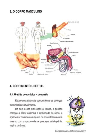 Doenças sexualmente transmissíveis | 11
3. O CORPO MASCULINO
4. CORRIMENTO URETRAL
4.1. Uretrite gonocócica – gonorréia
Esta é uma das mais comuns entre as doenças
transmitidas sexualmente.
De seis a oito dias após a transa, a pessoa
começa a sentir ardência e dificuldade ao urinar e
apresentar corrimento amarelo ou esverdeado ou até
mesmo com um pouco de sangue, que sai do pênis,
vagina ou ânus.
^
^
´
´
´
^
^
 