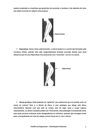postura empinada ou moçinhas que gostariam de aumentar o bumbum, não sabendo do risco
que estão correndo em adquirir essa postura.




                                                     Hiperlordose




   •   Hipercifose: Como vimos anteriormente, a coluna torácica e a sacral são formadas pela
curvatura Cifose, quando esta está exageradamente formada (curvada demais para fora)
dissemos que há uma Hipercifose; fica parecendo uma “corcunda”, um ovo na coluna.




                                                               Hipercifose




   •   Hérnia de Disco: Está lembrado da “geleinha” que explicamos que se localiza entre os
ossos da coluna? Pois é, a Hérnia de Disco é uma patologia que atinge este disco
intervertebral, fazendo com que este se rompa, saia do lugar certo e ocupe lugares
inapropriados, os danos causados podem ser irreversíveis. Esta patologia é considerada séria,
pois pode provocar sintomas muito desagradáveis ao indivíduo; pessoas que carregam muito
peso, principalmente em cima da cabeça correm riscos de vir a ter a hérnia.




                      Cartilha de Ergonomia – Orientações Posturais                        6
 