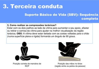 11
5. Como realizar as compressões torácicas?
Estar com os dois joelhos ao lado da vítima para aumentar o seu apoio, afastar
ou retirar a camisa da vítima para ajudar na melhor visualização da região
torácica. OBS: A vítima deve estar deitada com as costas voltadas para o chão
(numa superfície plana e rígida) formando um ângulo de 90 graus.
Posição correta da manobra de
RCP
Posição das mãos no tórax
(região entre os peitos da pessoa)
3. Terceira conduta
Suporte Básico de Vida (SBV): Sequência
completa
 