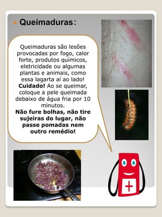 Queimaduras: 
Queimaduras são lesões provocadas por fogo, calor forte, produtos químicos, eletricidade ou algumas plantas e animais, como essa lagarta aí ao lado! Cuidado! Ao se queimar, coloque a pele queimada debaixo de água fria por 10 minutos. Não fure bolhas, não tire sujeiras do lugar, não passe pomadas nem outro remédio!  