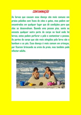 CONTAMINAÇÃO
As larvas que causam essa doença são mais comuns em
praias poluídas com fezes de cães e gatos, mas podem ser
encontradas em qualquer lugar que dê condições para que
elas se desenvolvam. Quando uma pessoa pisa, senta ou
encosta qualquer outra parte do corpo no local onde há
larvas, estas podem perfurar a pele e contaminar a pessoa.
As partes do corpo que são mais atingidas pela larva são o
bumbum e os pés. Essa doença é mais comum em crianças,
por ficarem brincando na areia da praia, mas também pode
infectar adulto.
 
