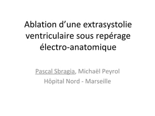 Ablation d’une extrasystolie
ventriculaire sous repérage
    électro-anatomique

  Pascal Sbragia, Michaël Peyrol
     Hôpital Nord - Marseille
 