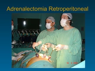 Adrenalectomia Retroperitoneal 