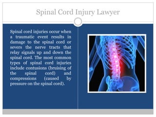 Spinal Cord Injury Lawyer

Spinal cord injuries occur when
a traumatic event results in
damage to the spinal cord or
severs the nerve tracts that
relay signals up and down the
spinal cord. The most common
types of spinal cord injuries
include contusions (bruising of
the     spinal     cord)    and
compressions      (caused     by
pressure on the spinal cord).
 