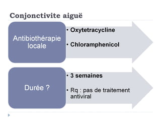 Conjonctivite aiguë
 